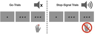 Electrophysiological Evidence for Distinct Proactive Control Mechanisms in a Stop-Signal Task: An Individual Differences Approach